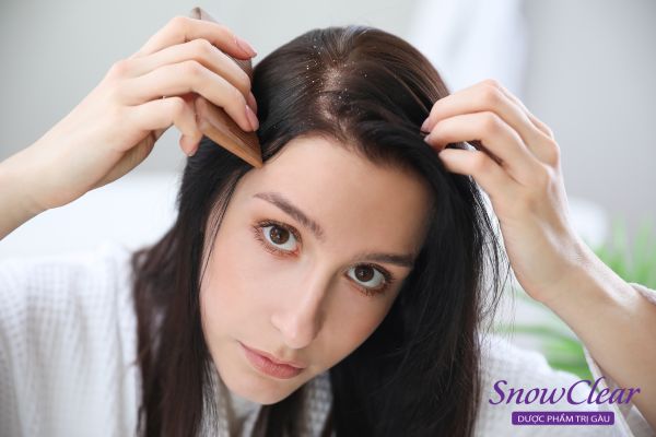 Nội tiết tố thay đổi làm tăng tiết tuyến bã nhờn da đầu