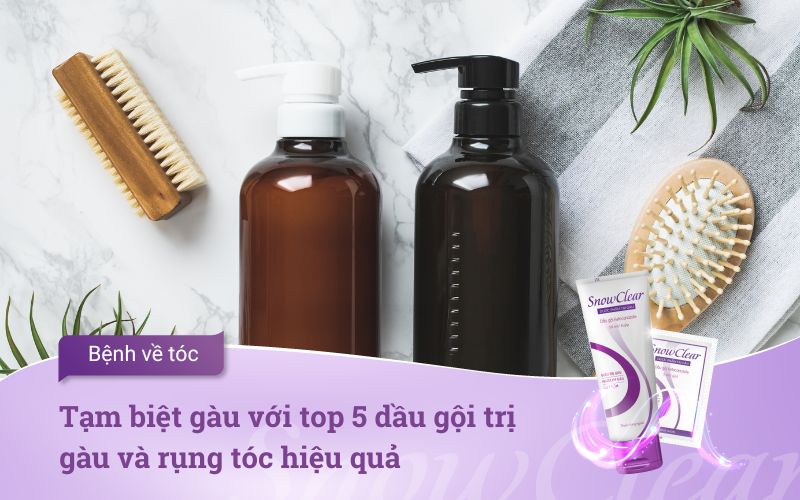 Tạm biệt gàu với top 5 dầu gội trị gàu và rụng tóc hiệu quả