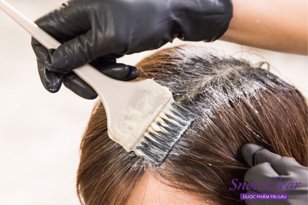 Da đầu sau khi nhuộm tóc thường hay có gàu do tiếp xúc trực tiếp với hóa chất nhuộm