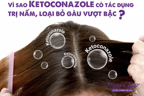 Thành phần chứa Ketoconazole có tác dụng trị gàu 