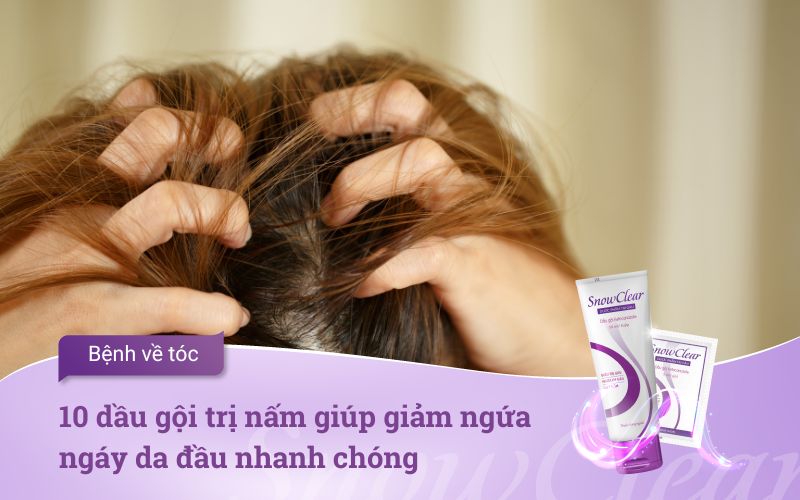 10 dầu gội trị nấm giúp giảm ngứa ngáy da đầu nhanh chóng