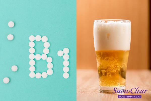 Cách trị gàu bằng bia với Vitamin B1