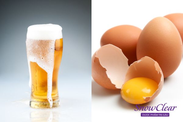 Cách trị gàu bằng bia và trứng
