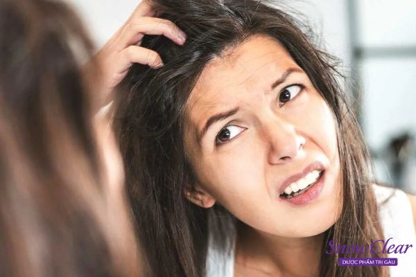 Biểu hiện của gàu