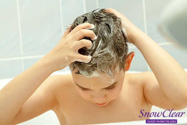Nấm da đầu ở trẻ em do vệ sinh da đầu không sạch sẽ