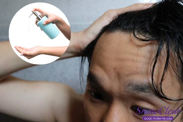 Sử dụng dầu gội kích thích tóc mọc