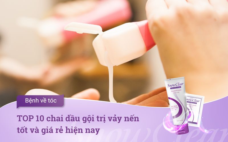 TOP 10 chai dầu gội trị vảy nến tốt và giá rẻ hiện nay