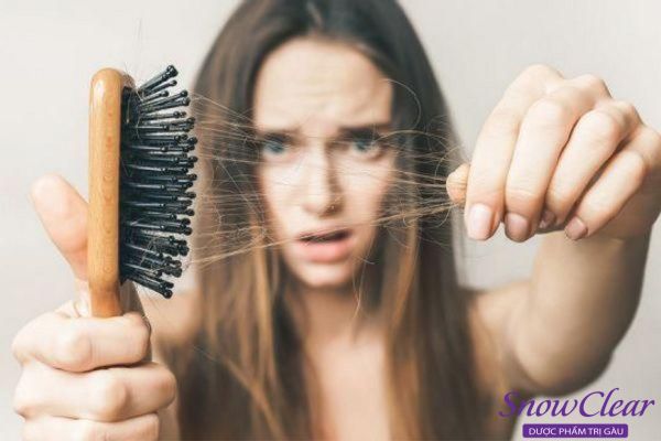 Rụng tóc ở tuổi dậy thì là một quá trình thay đổi sinh lý bình thường của cơ thể