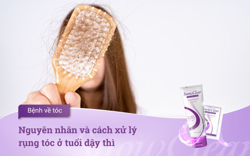 Nguyên nhân và cách xử lý rụng tóc ở tuổi dậy thì