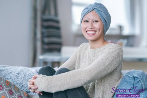 Xạ trị trong điều trị ung thư cũng là một trong những nguyên nhân tóc rụng