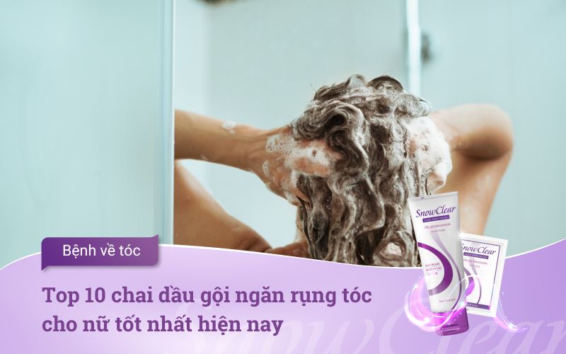 Top 10 chai dầu gội ngăn rụng tóc cho nữ tốt nhất hiện nay