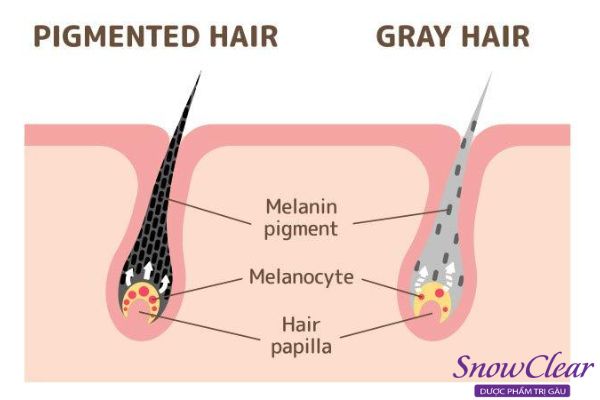 Nguyên nhân tóc bạc sớm do thiếu hụt sắc tố melanin
