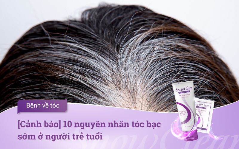 [Cảnh báo] 10 nguyên nhân tóc bạc sớm ở người trẻ tuổi
