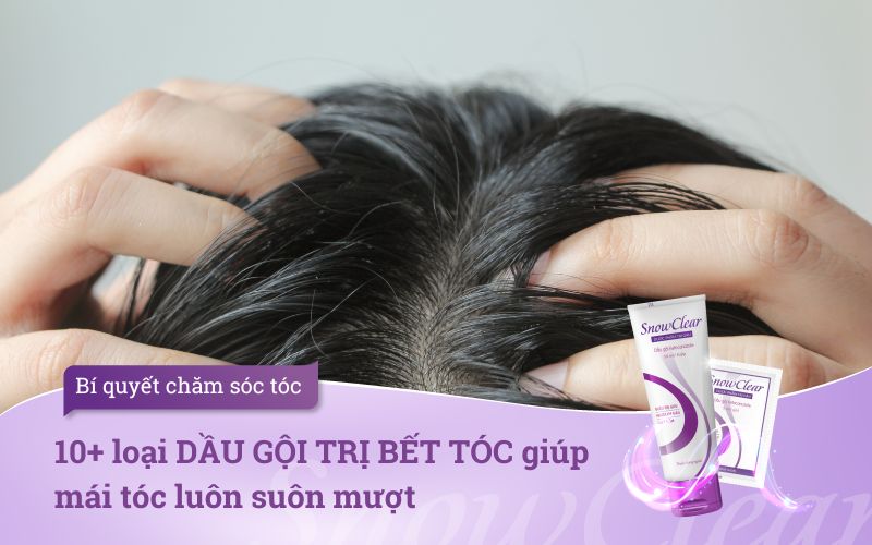 10+ loại DẦU GỘI TRỊ BẾT TÓC giúp mái tóc luôn suôn mượt