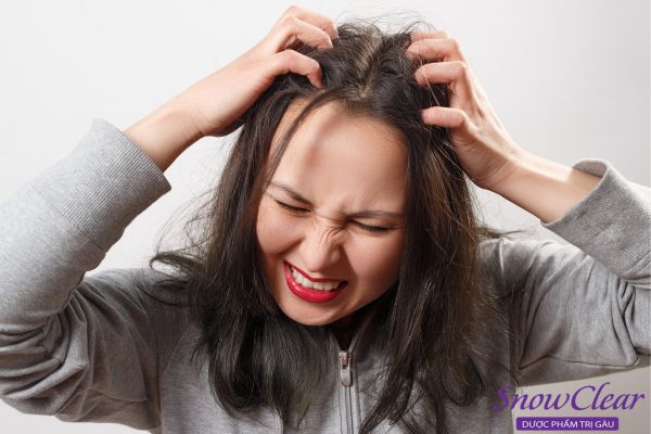 Ngứa ngáy là triệu chứng nấm da đầu dễ thấy