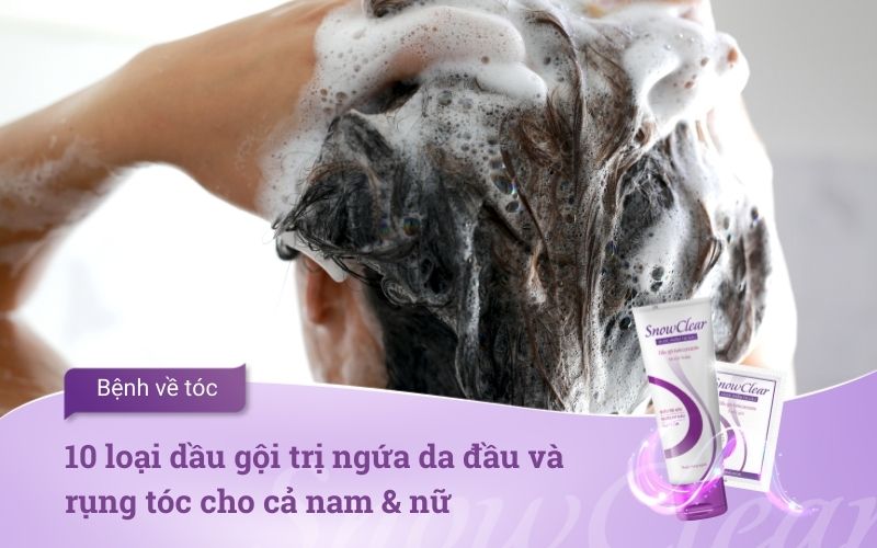 10 loại dầu gội trị ngứa da đầu và rụng tóc cho cả nam & nữ