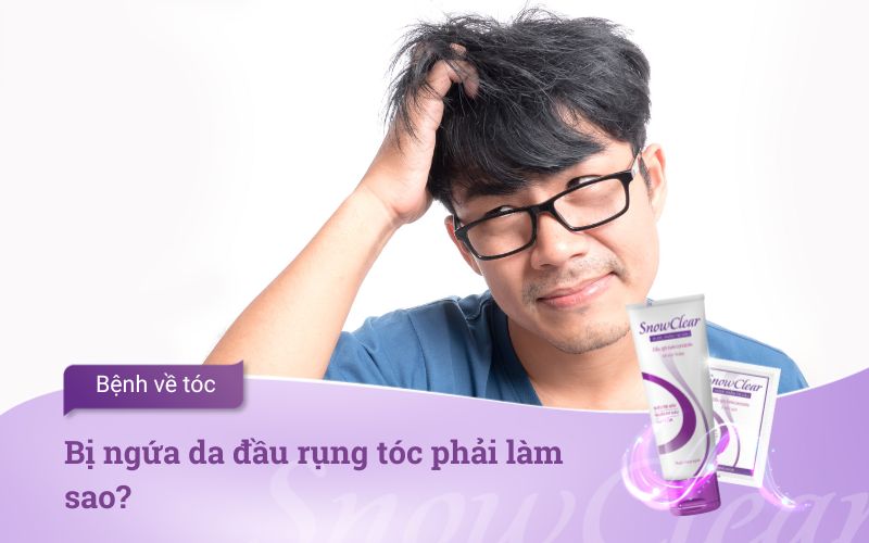 Bị ngứa da đầu rụng tóc phải làm sao?