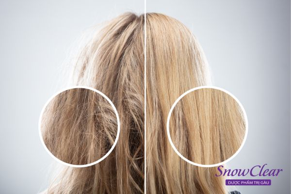 Duỗi tóc bằng hơi nước giúp phục hồi tóc hư tổn