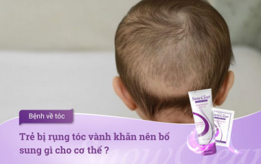 Trẻ bị rụng tóc vành khăn nên bổ sung gì cho cơ thể ?