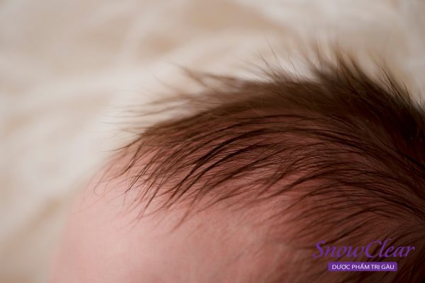 Tóc máu ở trẻ sẽ rụng dần khi bé đến 2-3 tháng tuổi