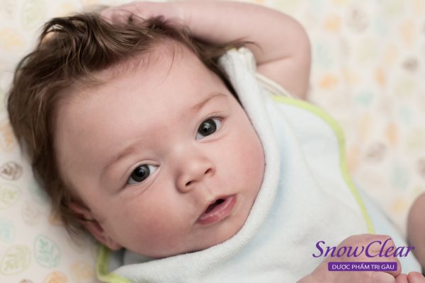 Thói quen bứt tóc khiến rụng tóc vành khăn ở trẻ sơ sinh