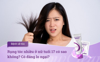 Rụng tóc nhiều ở nữ tuổi 17 có sao không? Có đáng lo ngại?