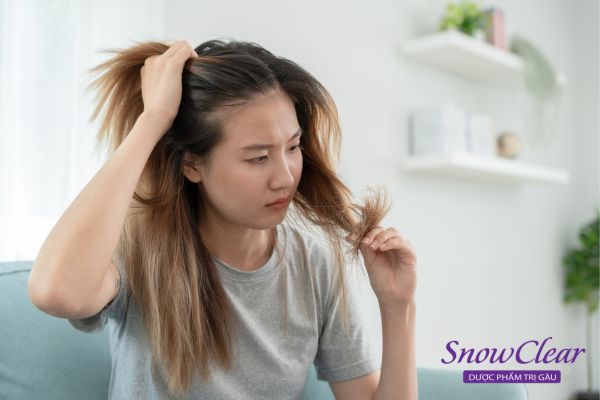 Tình trạng rụng tóc nhiều ở nữ tuổi 17 có sao không ?
