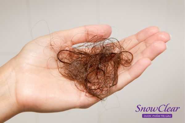 Khi vào mùa rụng tóc tóc thường rụng nhiều hơn