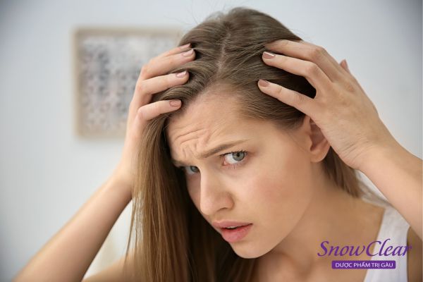 Gàu nấm da đầu gây ra rụng tóc nhiều ở nữ