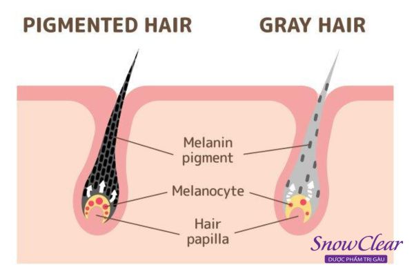 Tóc bạc là do hàm lượng melanin trong tóc ít 
