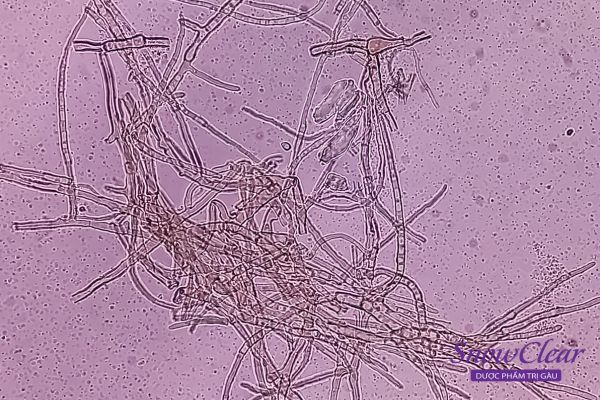 Hình ảnh vi nấm malassezia dưới kính hiển vi 