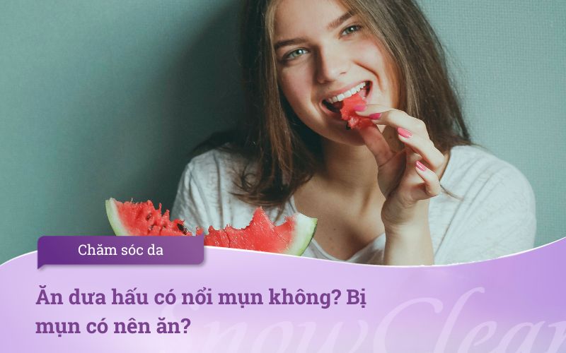 Ăn dưa hấu có nổi mụn không? Bị mụn có nên ăn?