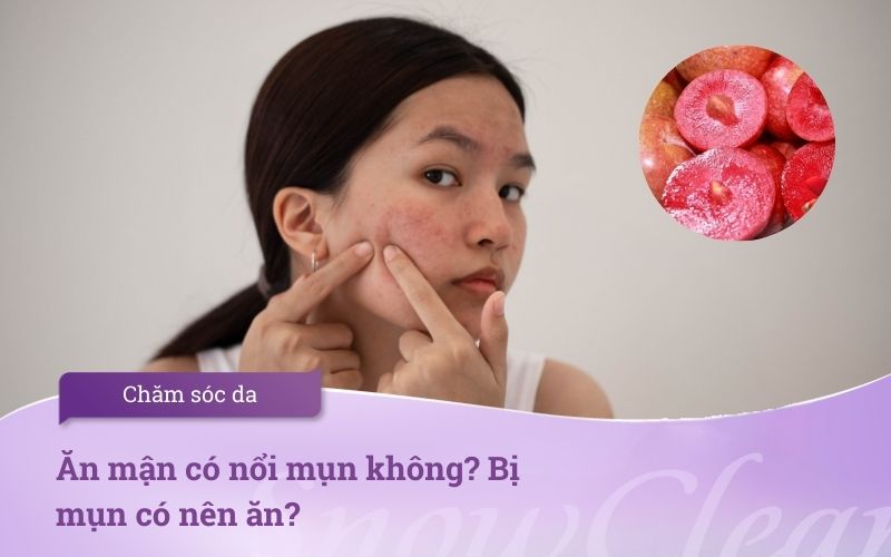 Ăn mận có nổi mụn không? Bị mụn có nên ăn?