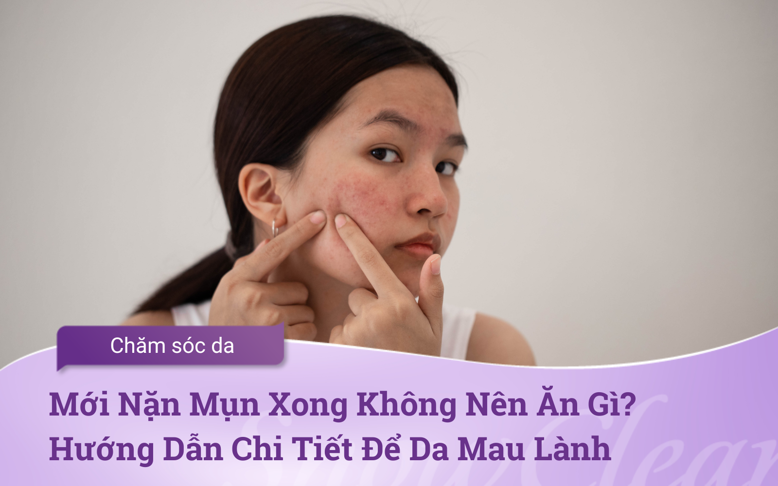 Mới Nặn Mụn Xong Không Nên Ăn Gì? Hướng Dẫn Chi Tiết Để Da Mau Lành
