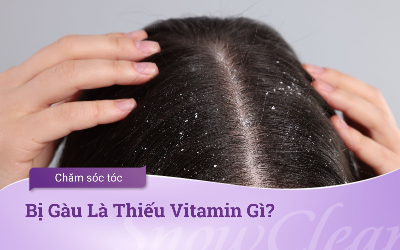 Bị Gàu Là Thiếu Vitamin Gì?