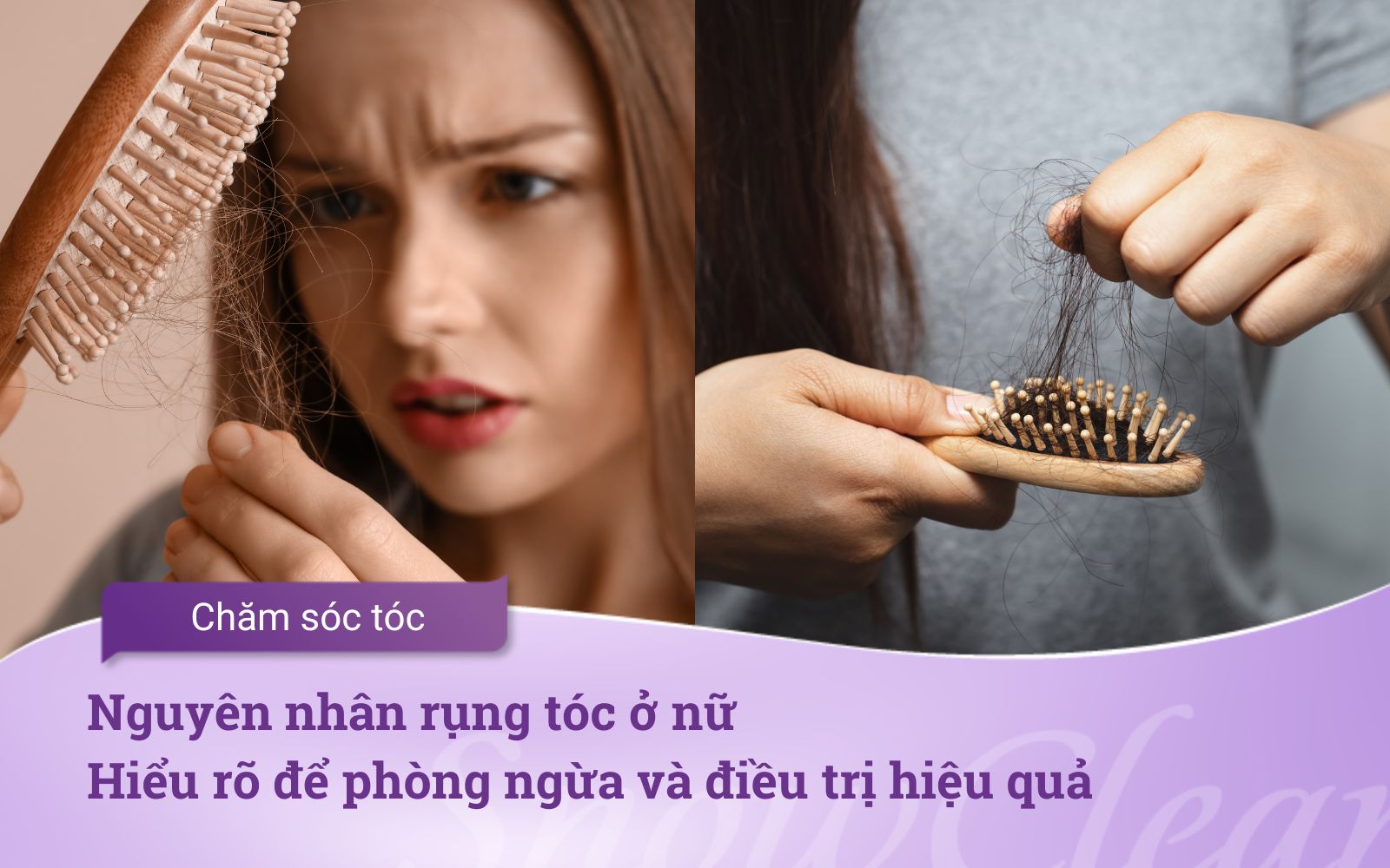 Nguyên nhân rụng tóc ở nữ Hiểu rõ để phòng ngừa và điều trị hiệu quả