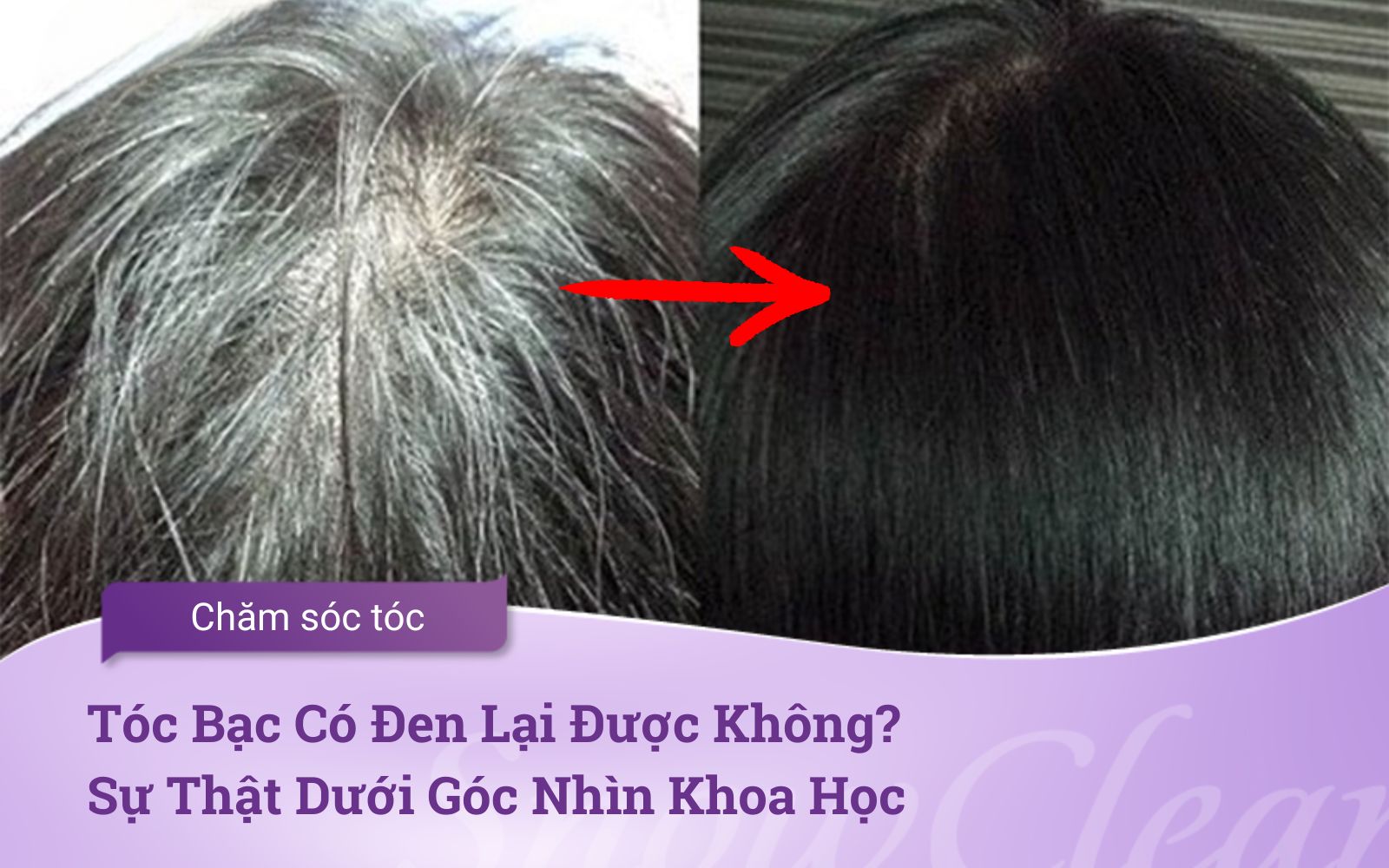Tóc Bạc Có Đen Lại Được Không? Sự Thật Dưới Góc Nhìn Khoa Học