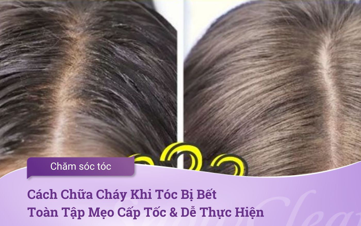 Cách Chữa Cháy Khi Tóc Bị Bết: Toàn Tập Mẹo Cấp Tốc & Dễ Thực Hiện