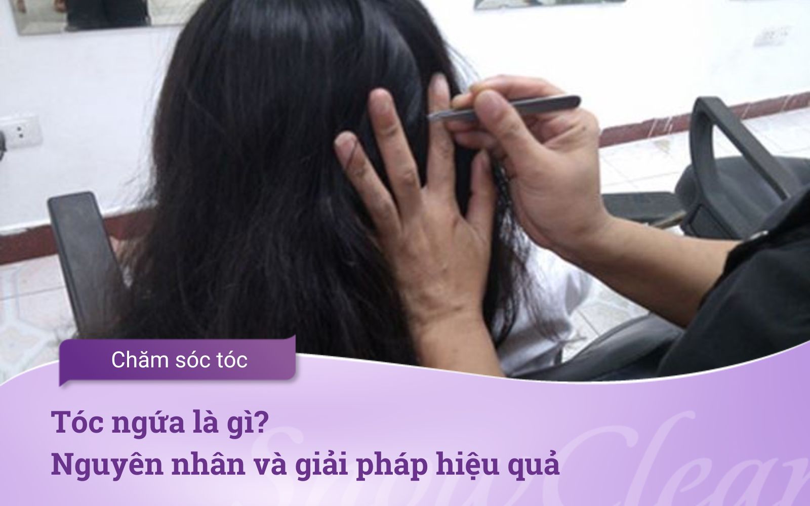 Tóc ngứa là gì? Nguyên nhân và giải pháp hiệu quả