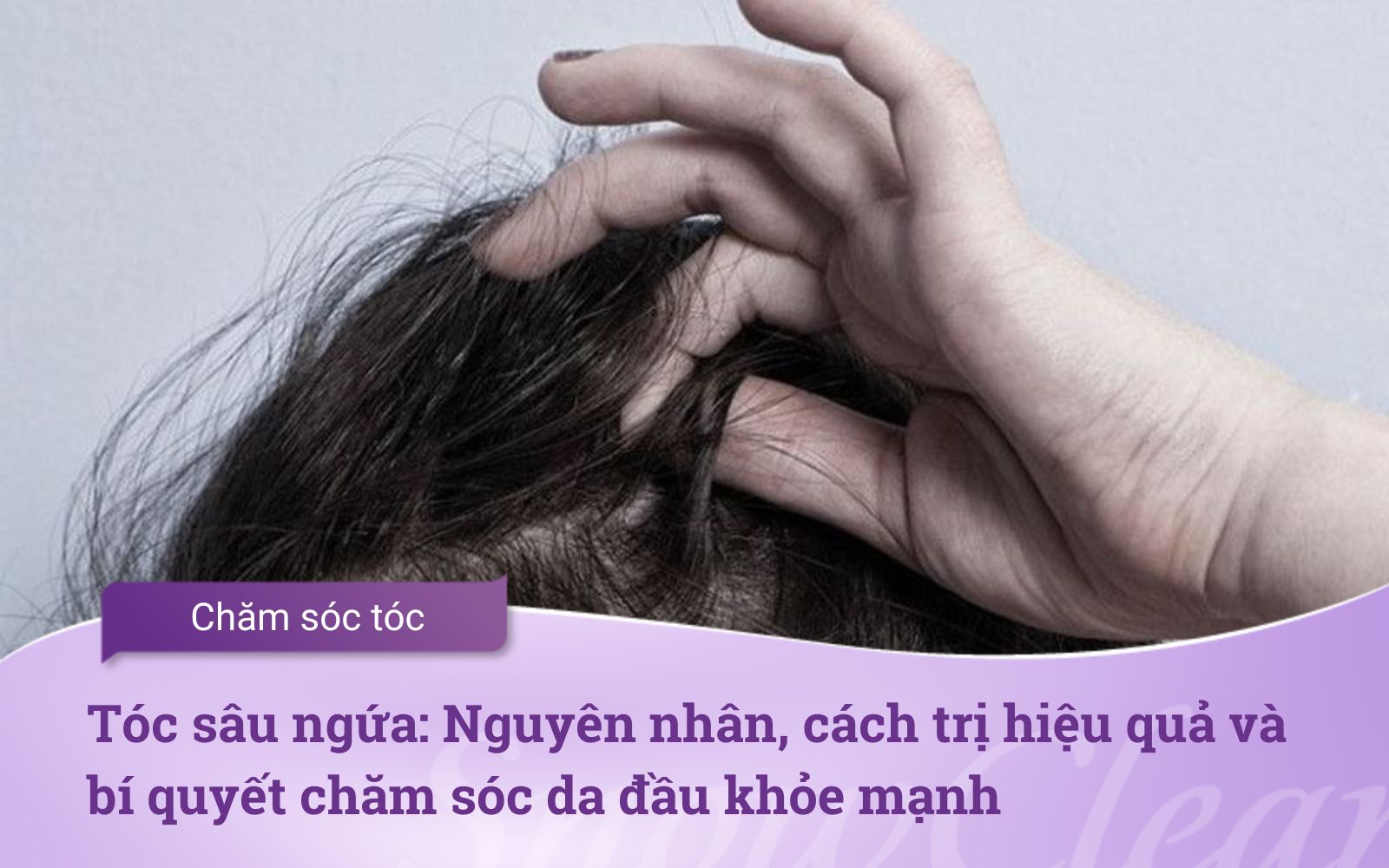 Tóc sâu ngứa: Nguyên nhân, cách trị hiệu quả và bí quyết chăm sóc da đầu khỏe mạnh