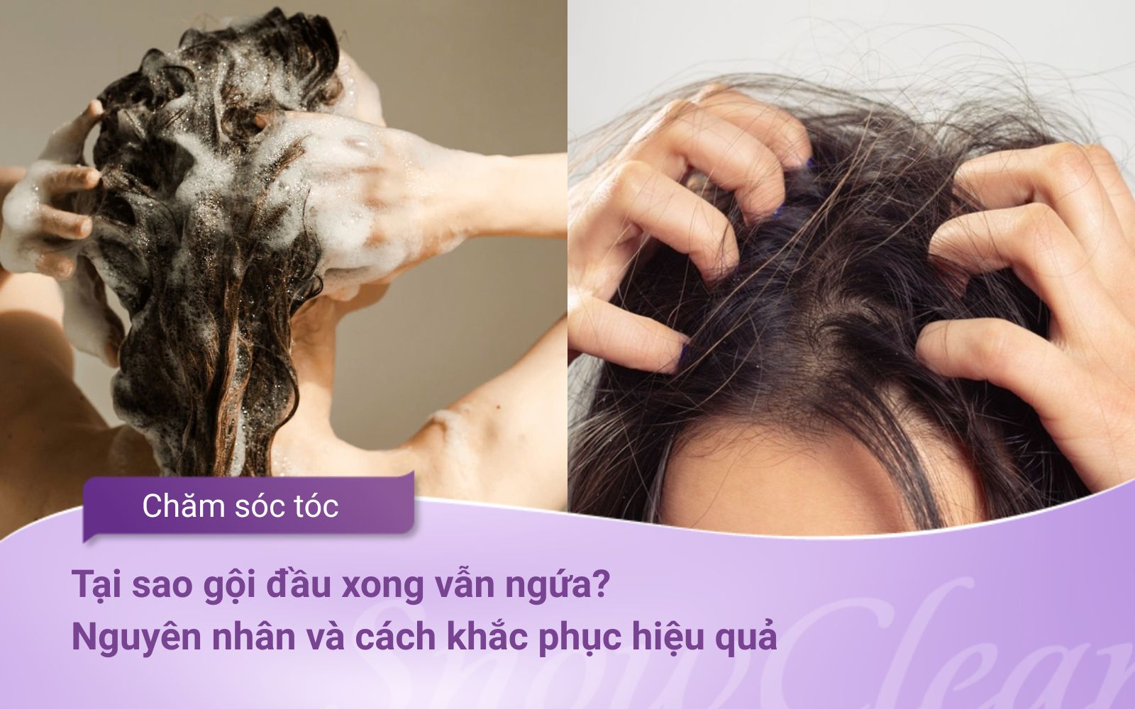 Tại sao gội đầu xong vẫn ngứa? Nguyên nhân và cách khắc phục hiệu quả