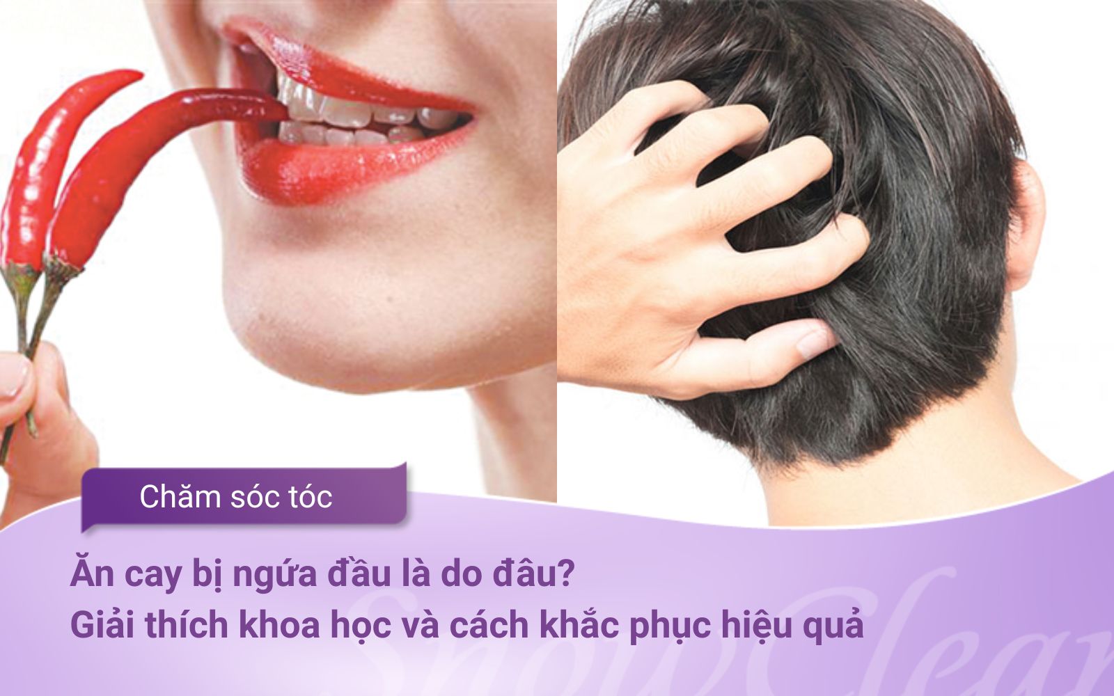 Ăn cay bị ngứa đầu là do đâu? Giải thích khoa học và cách khắc phục hiệu quả