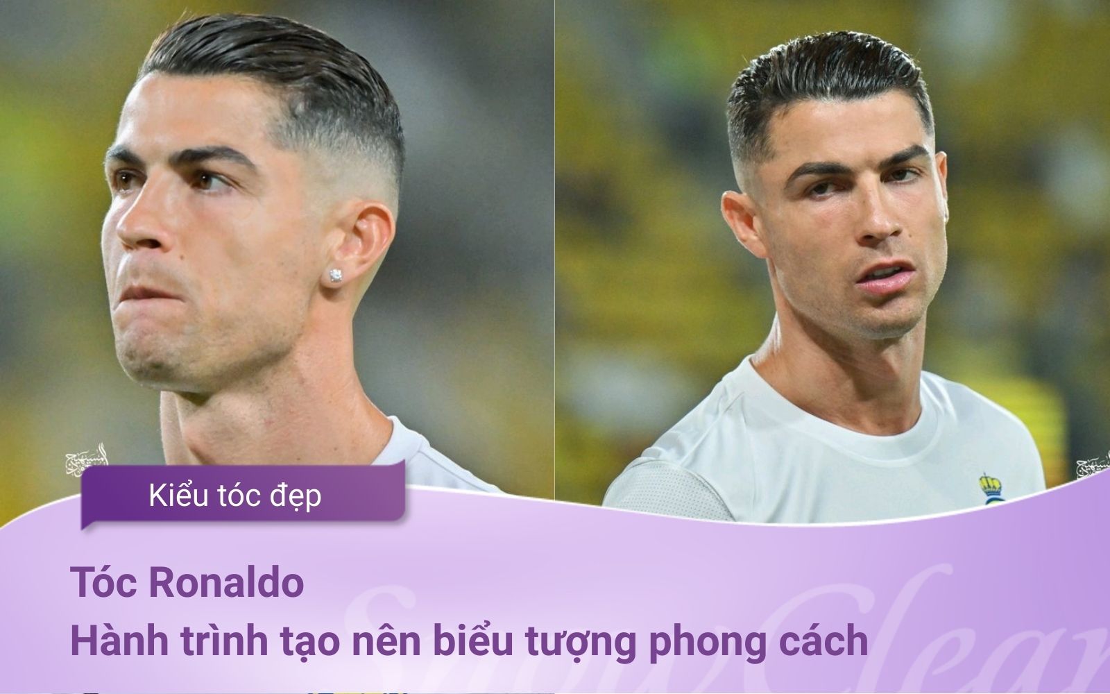 Tóc Ronaldo Hành trình tạo nên biểu tượng phong cách