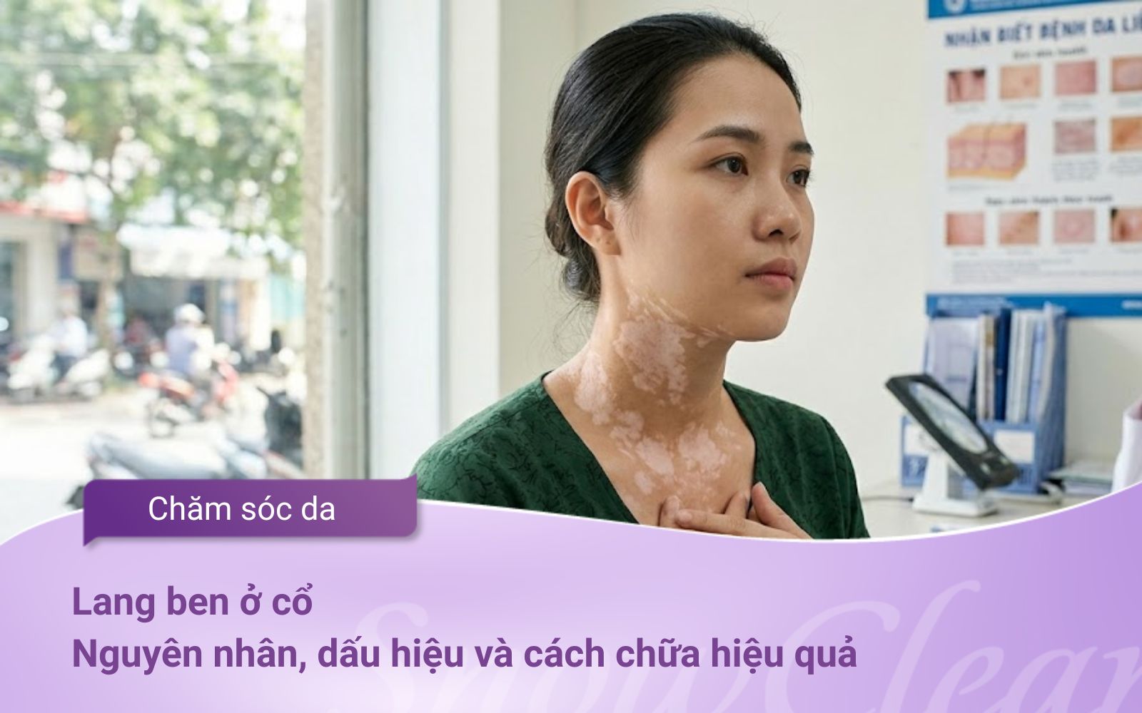 Lang ben ở cổ: Nguyên nhân, dấu hiệu và cách chữa hiệu quả