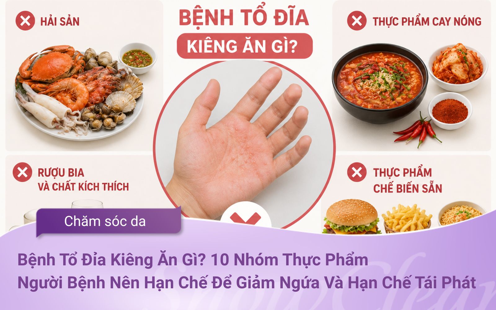 Bệnh Tổ Đỉa Kiêng Ăn Gì? 10 Nhóm Thực Phẩm Người Bệnh Nên Hạn Chế Để Giảm Ngứa Và Hạn Chế Tái Phát