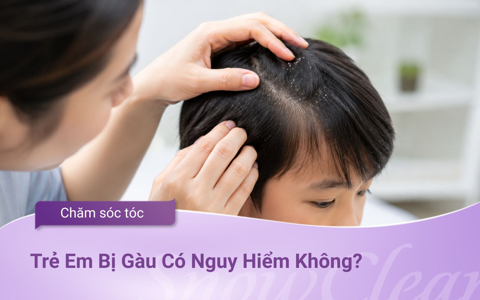 Trẻ Em Bị Gàu Có Nguy Hiểm Không? Giải Đáp Chi Tiết