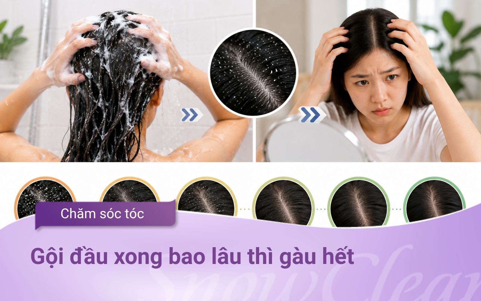 Gội đầu xong bao lâu thì gàu hết? Thời gian và cách chăm sóc da đầu đúng cách