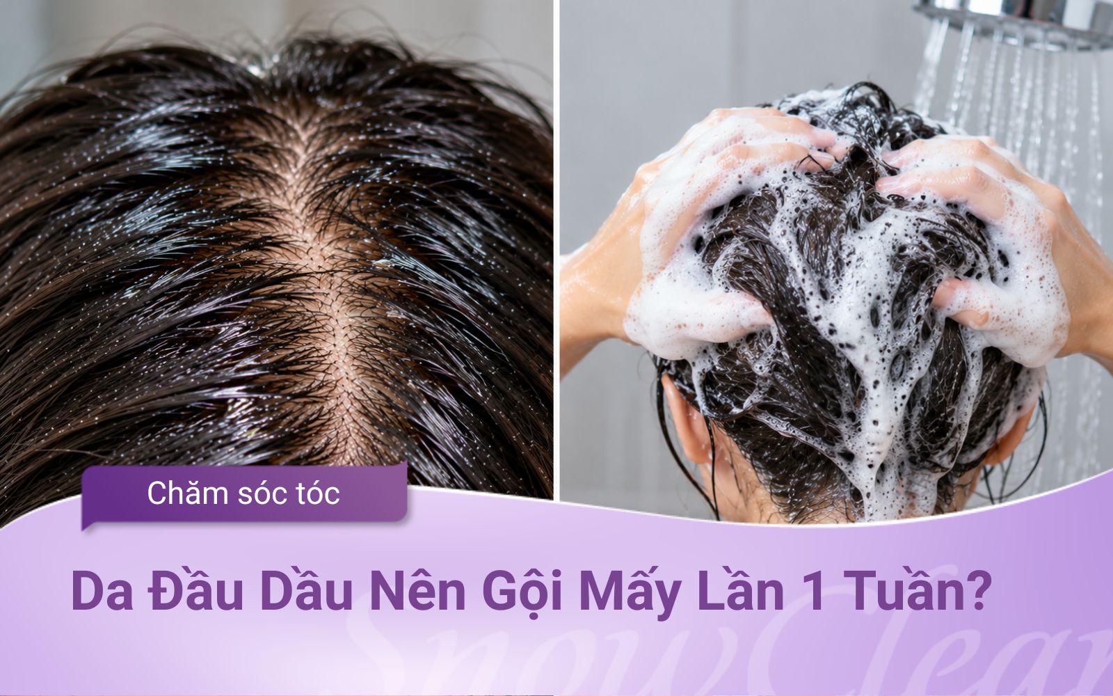 Da Đầu Dầu Nên Gội Mấy Lần 1 Tuần?